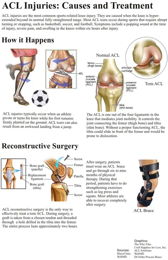 Acl healing without surgery